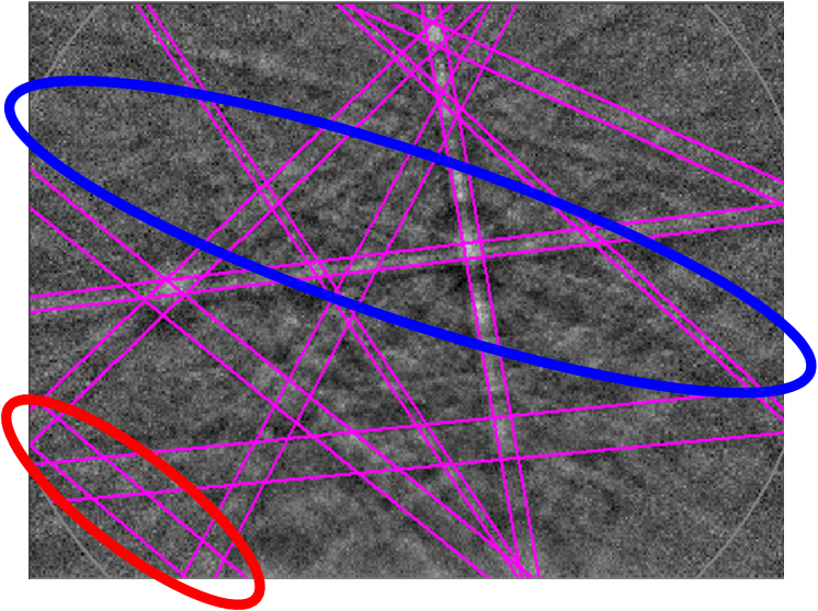 EBSD pattern showing the detected bands using a standard band detection approach