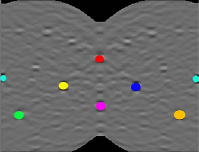 8つの最高強度のピークをマークした、Hough 空間の Si EBSD パターンの表示。