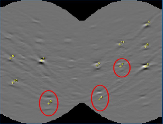 Hough transform image from the optimised band detection of an Al TKD pattern