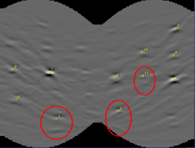 Hough transform image from the standard band detection of an Al TKD pattern